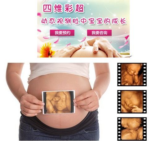 孕妇几个月可以做四维彩超